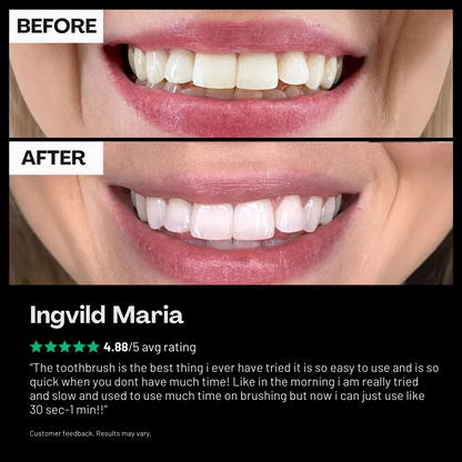 Sonic 360° Toothbrush